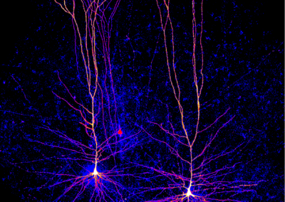 The redwoods of the cortex